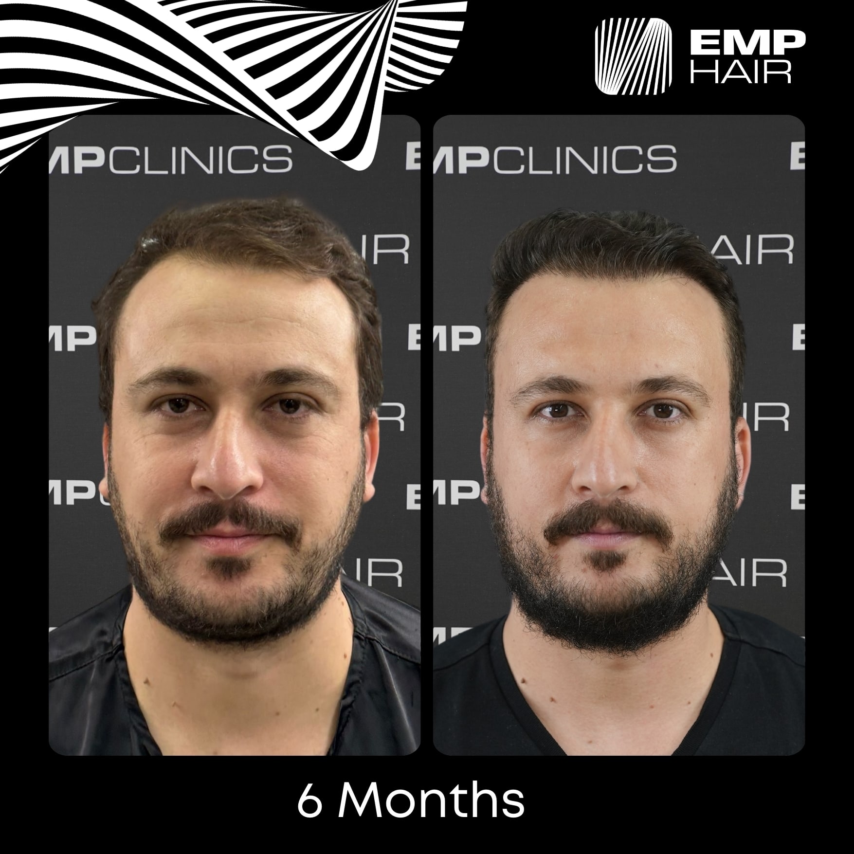 Before After Image 1