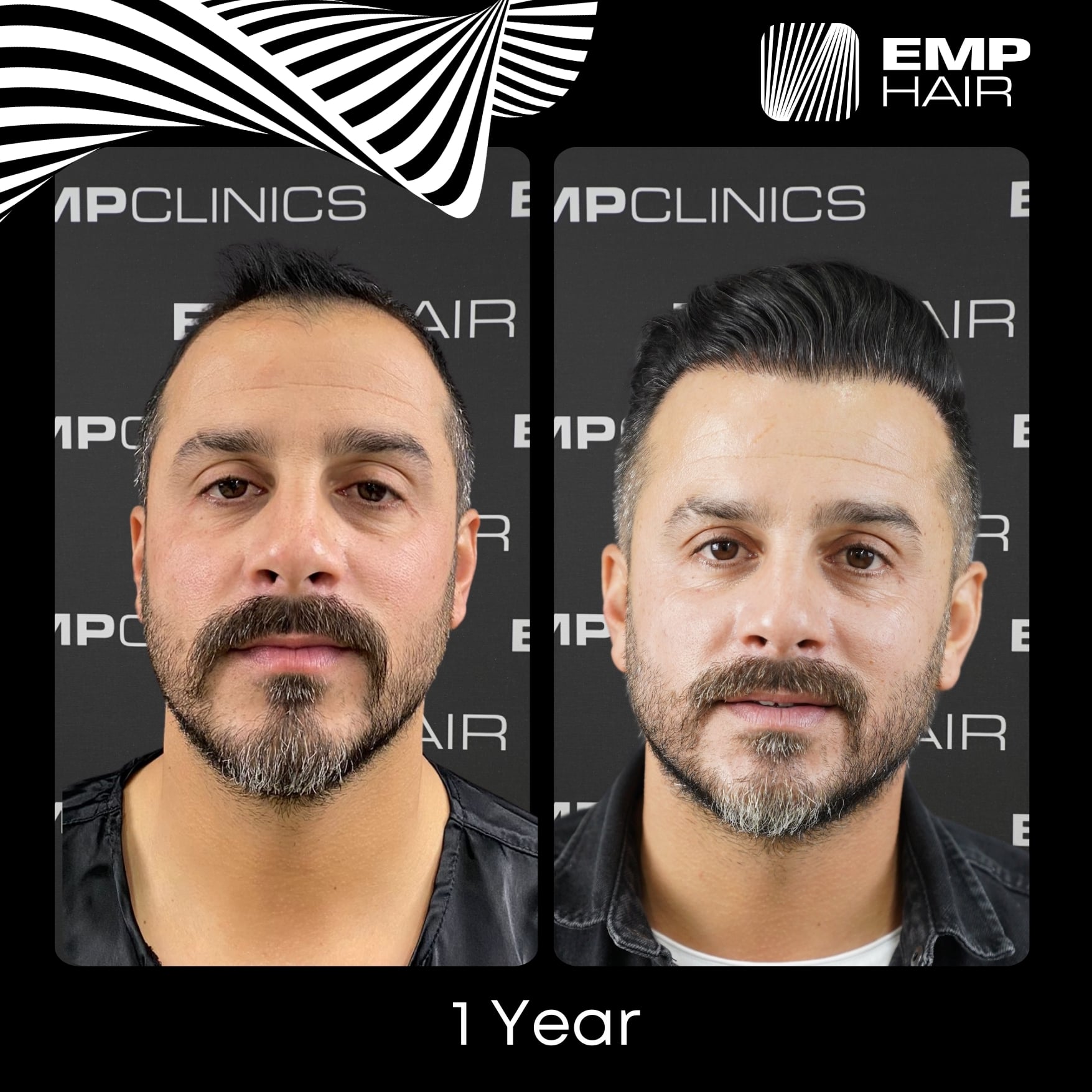 Before After Image 2