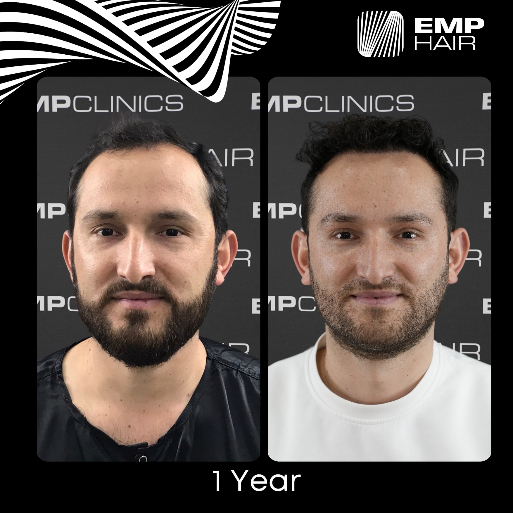 Before After Image 3