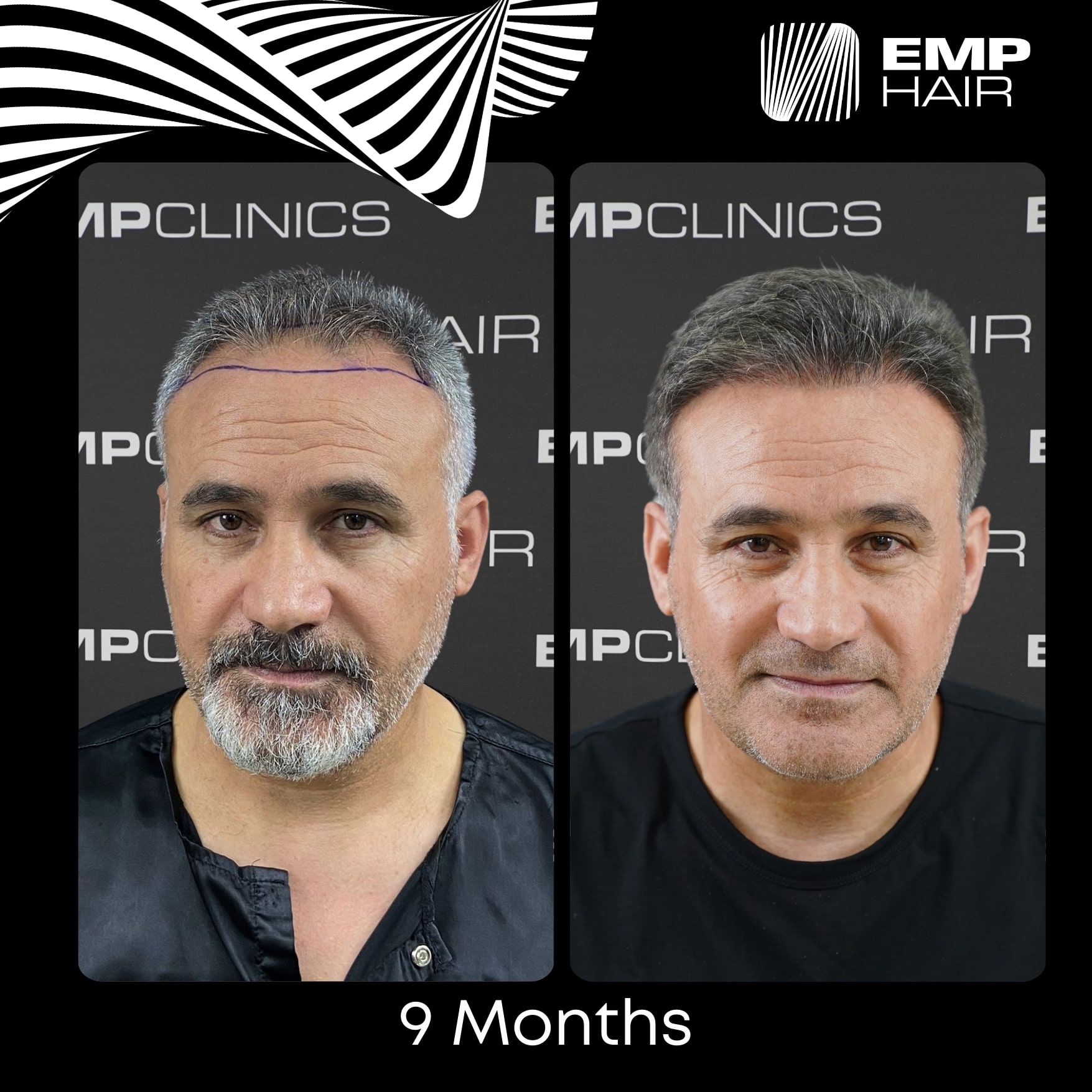 Before After Image 4