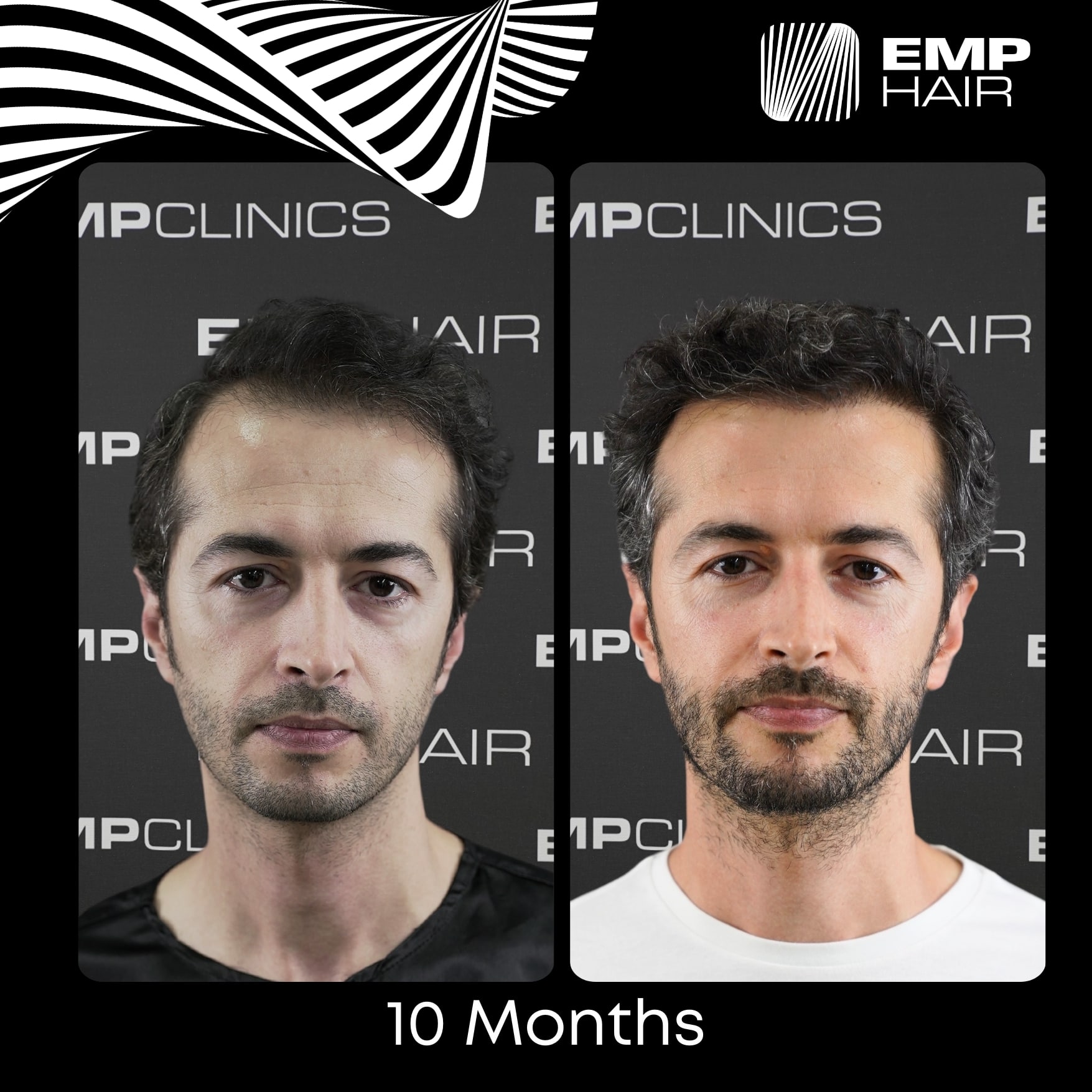 Before After Image 5