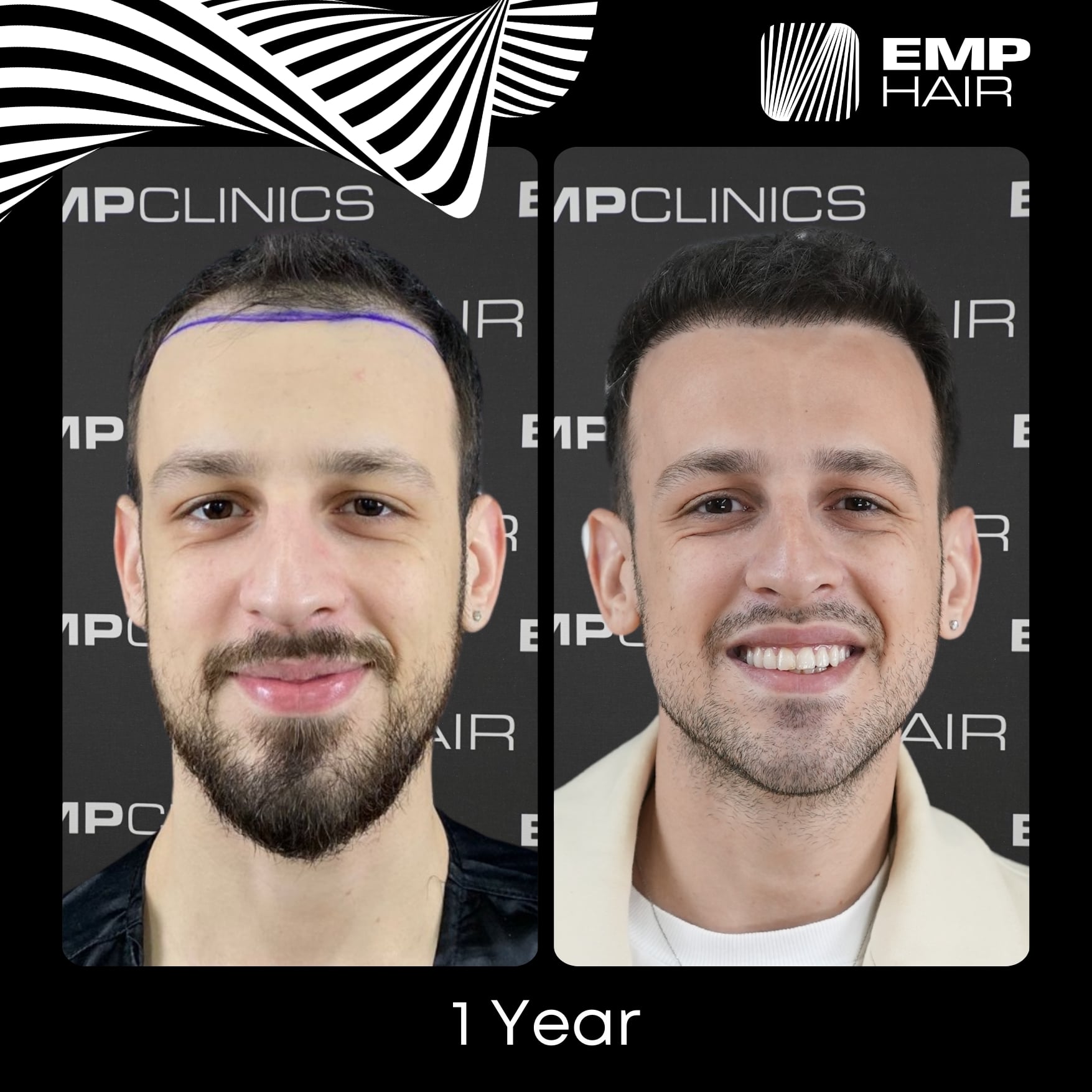 Before After Image 6