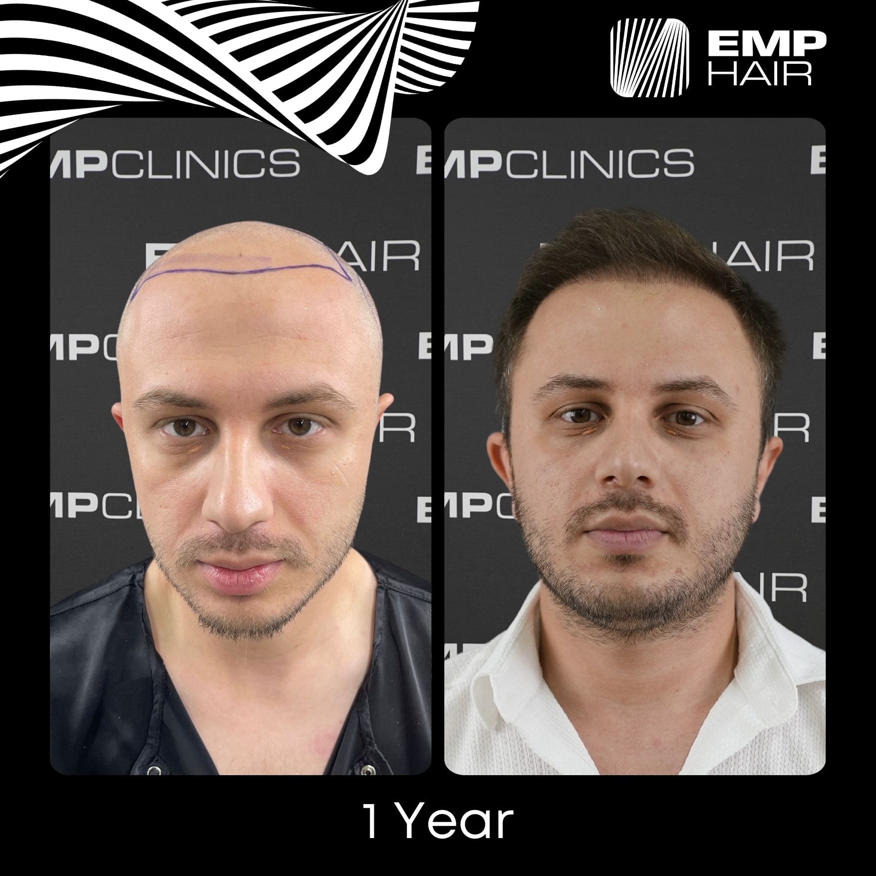 Before After Image 7