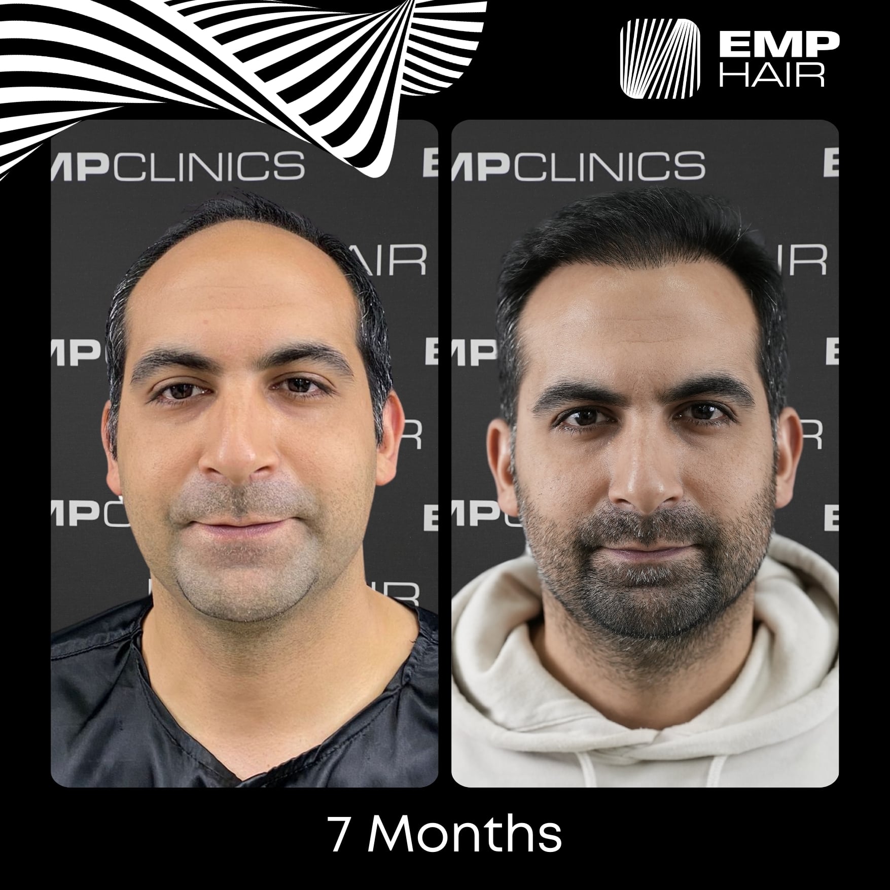 Before After Image 8