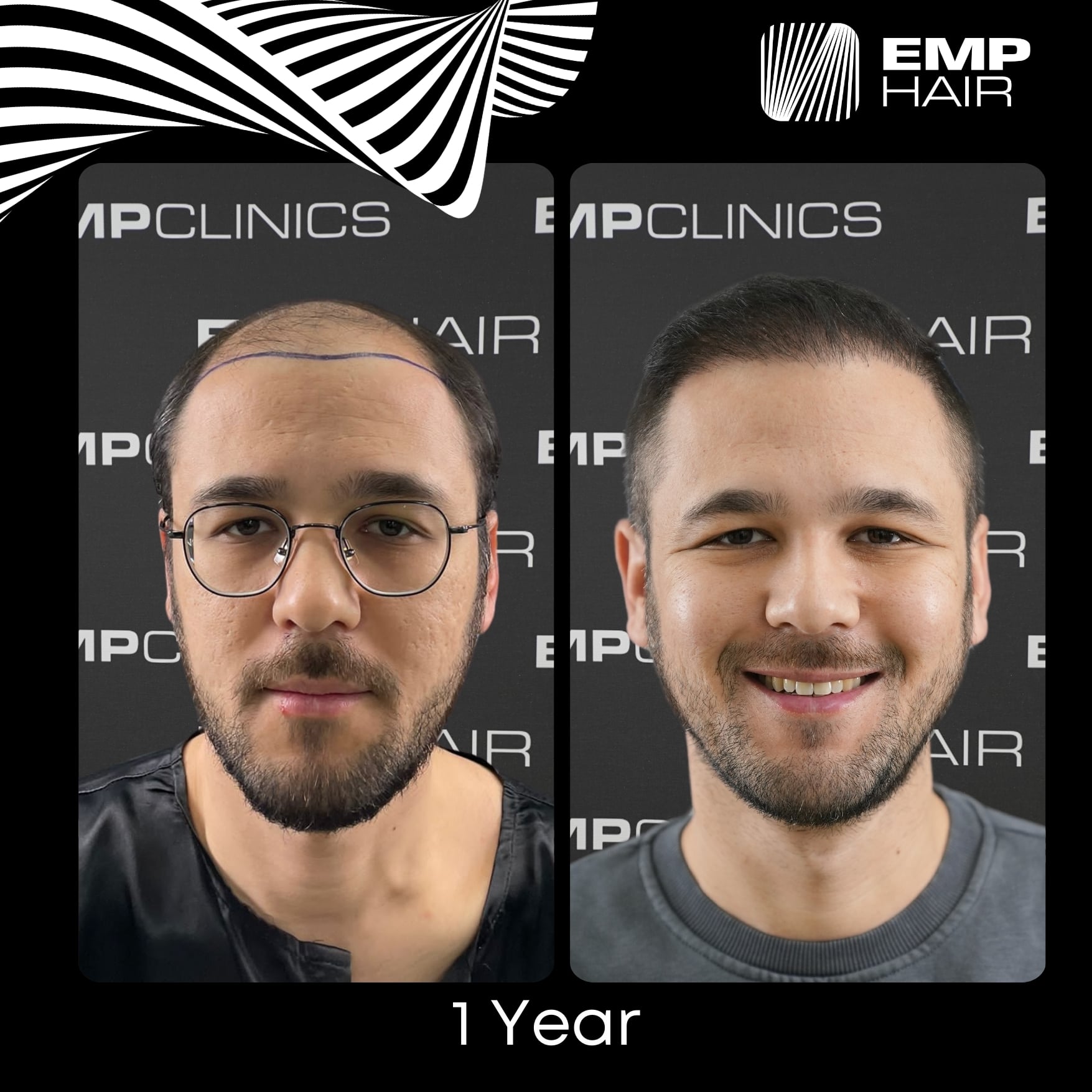 Before After Image 9