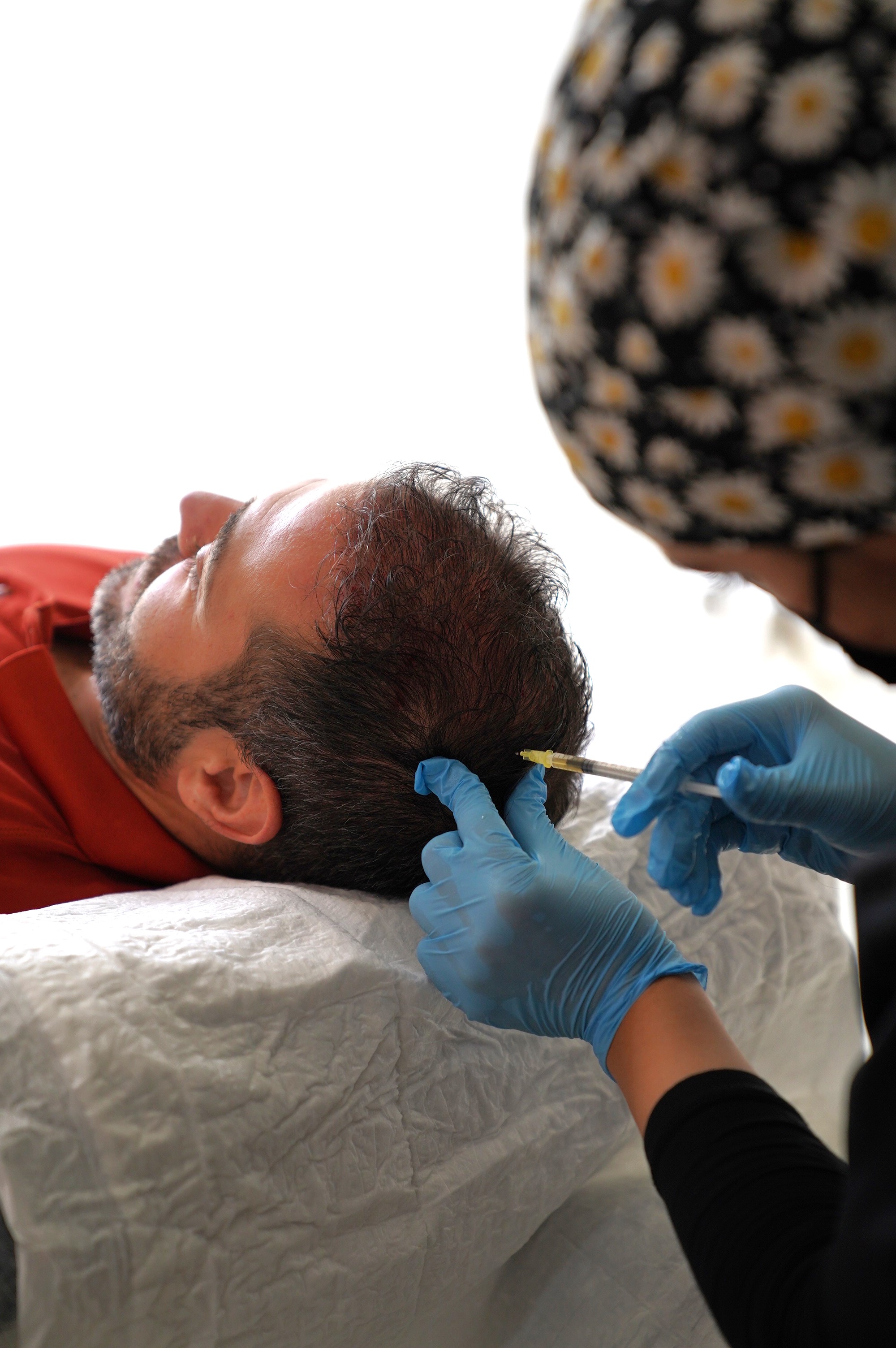 Hair Transplant Image 1