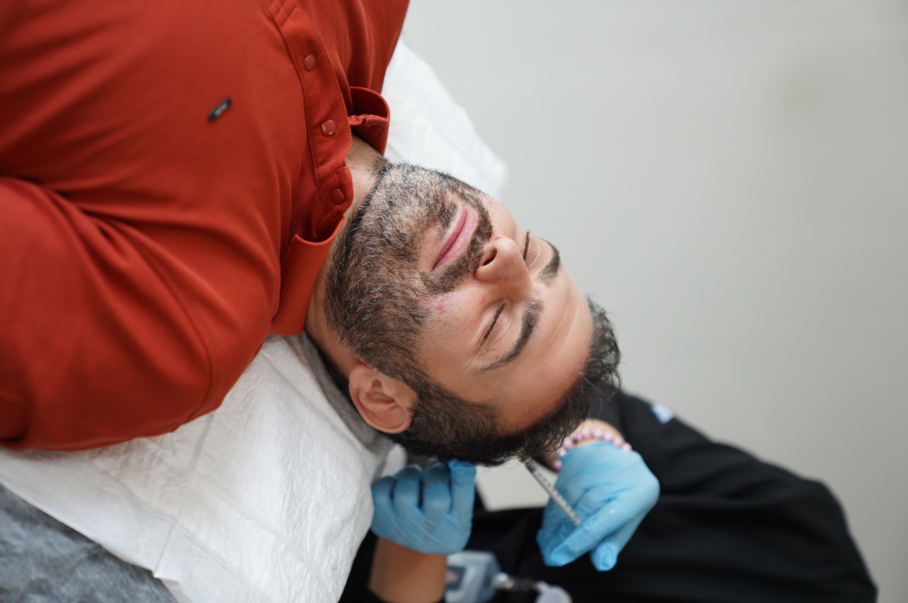 Hair Transplant Image 4