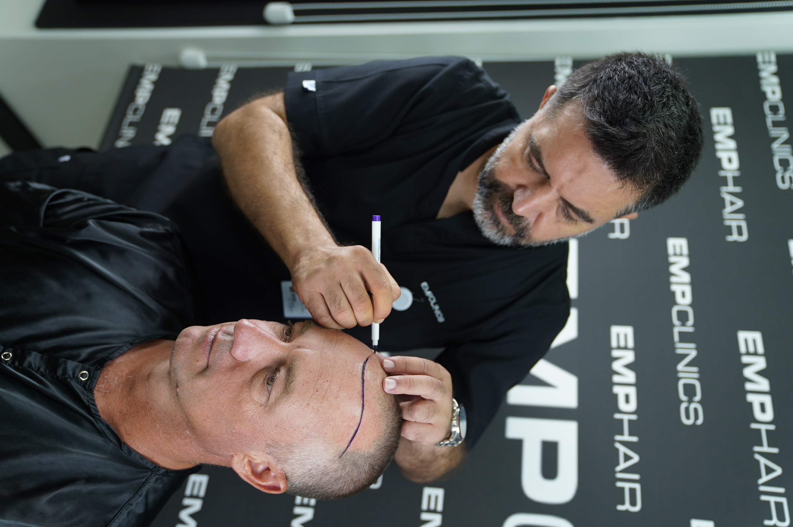 Hair Transplant Image 6